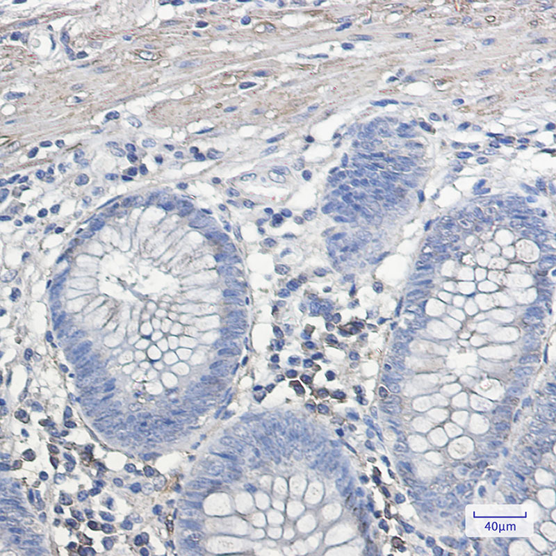 IL-11RA Rabbit mAb ABZ2127
