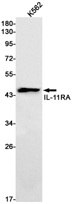 IL-11RA Rabbit mAb ABZ2127