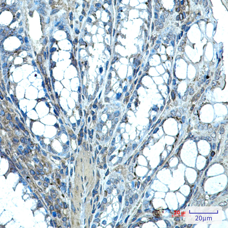 Ihh Rabbit mAb ABZ2128
