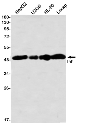 Ihh Rabbit mAb ABZ2128