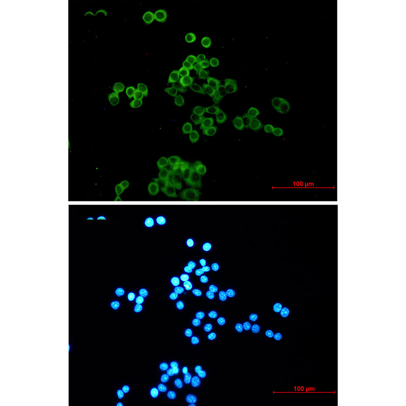 Desmocollin 3 Rabbit mAb ABZ2129