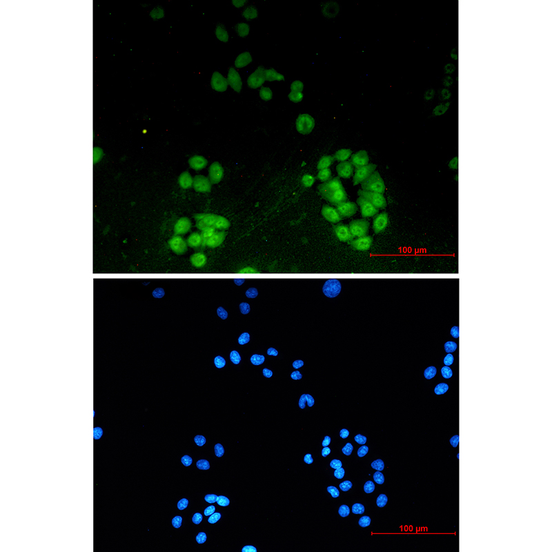 ENT2 Rabbit mAb ABZ2131