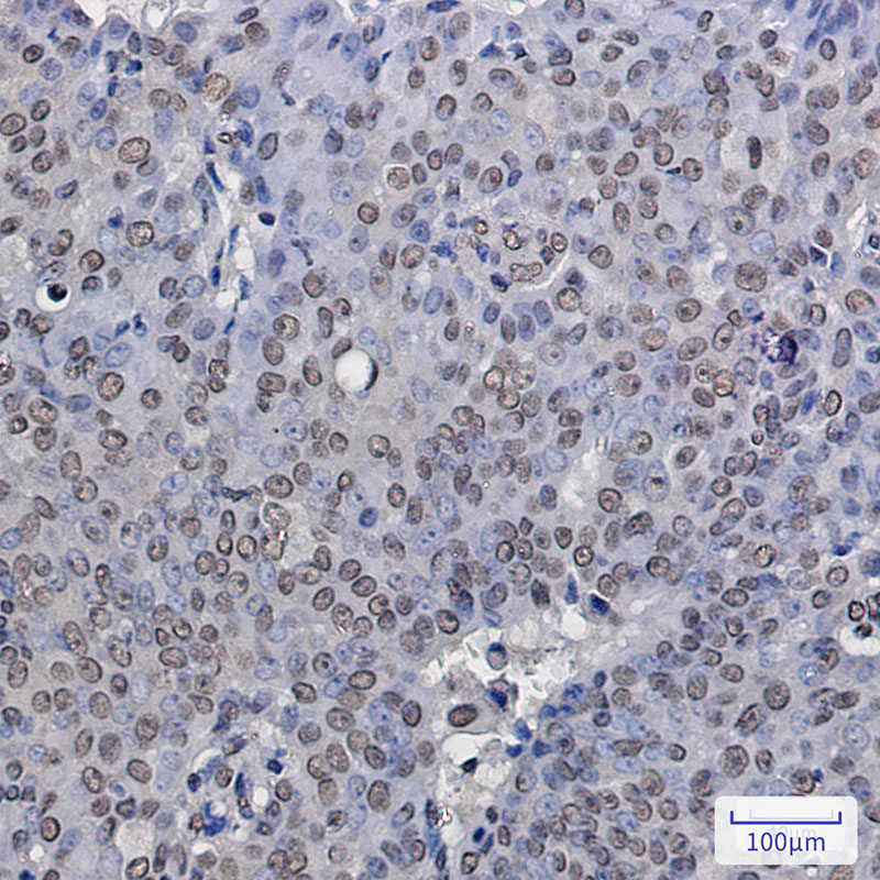 ENT2 Rabbit mAb ABZ2131