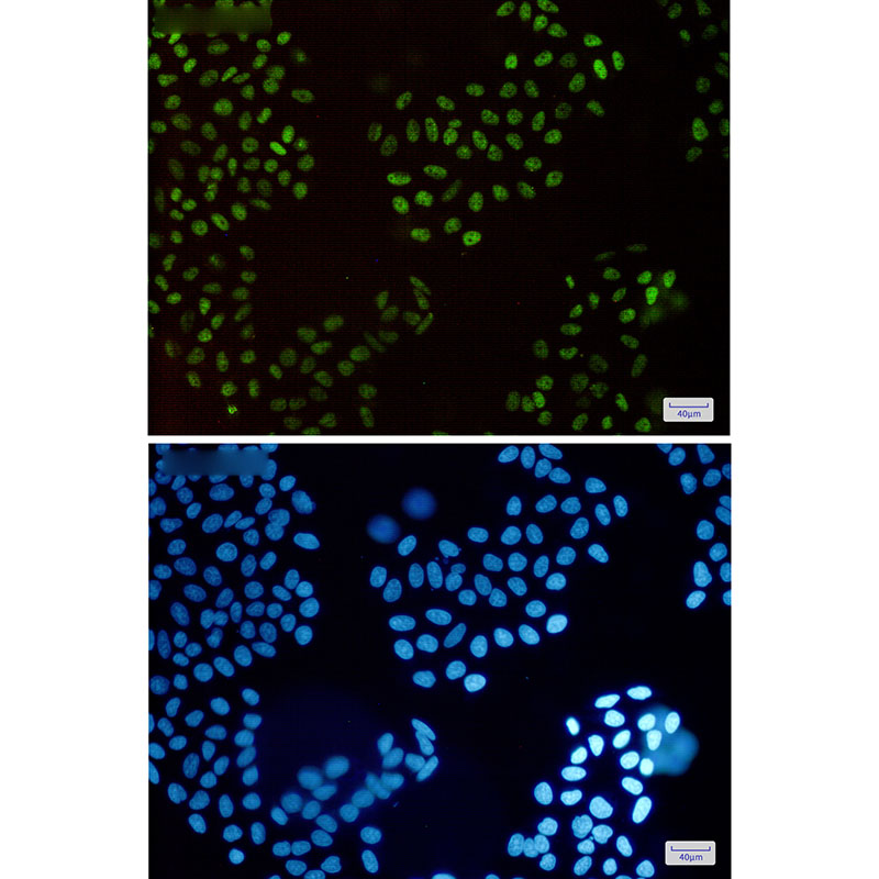 HLTF Rabbit mAb ABZ2132