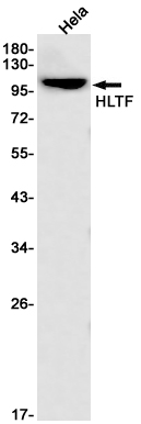 HLTF Rabbit mAb ABZ2132