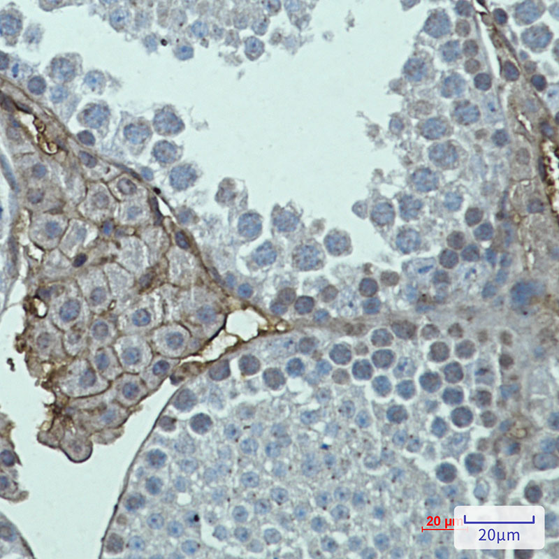 Metabotropic Glutamate Receptor 2 Rabbit mAb ABZ2133