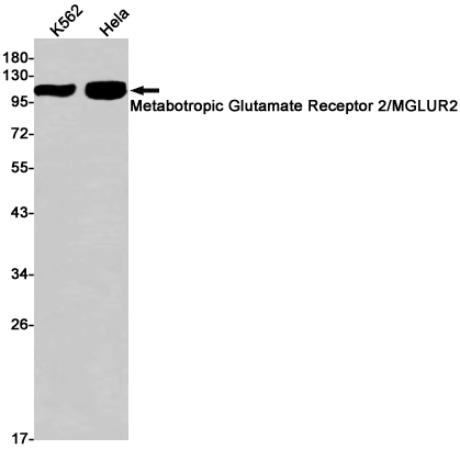 Metabotropic Glutamate Receptor 2 Rabbit mAb ABZ2133