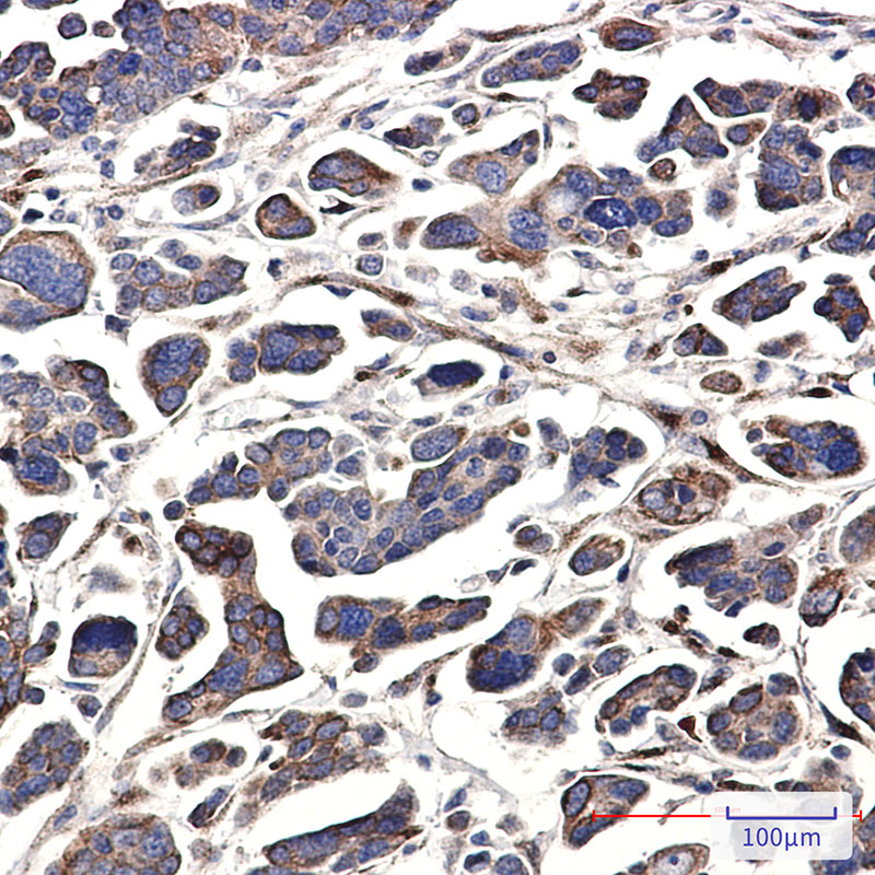 GNA13 Rabbit mAb ABZ2134