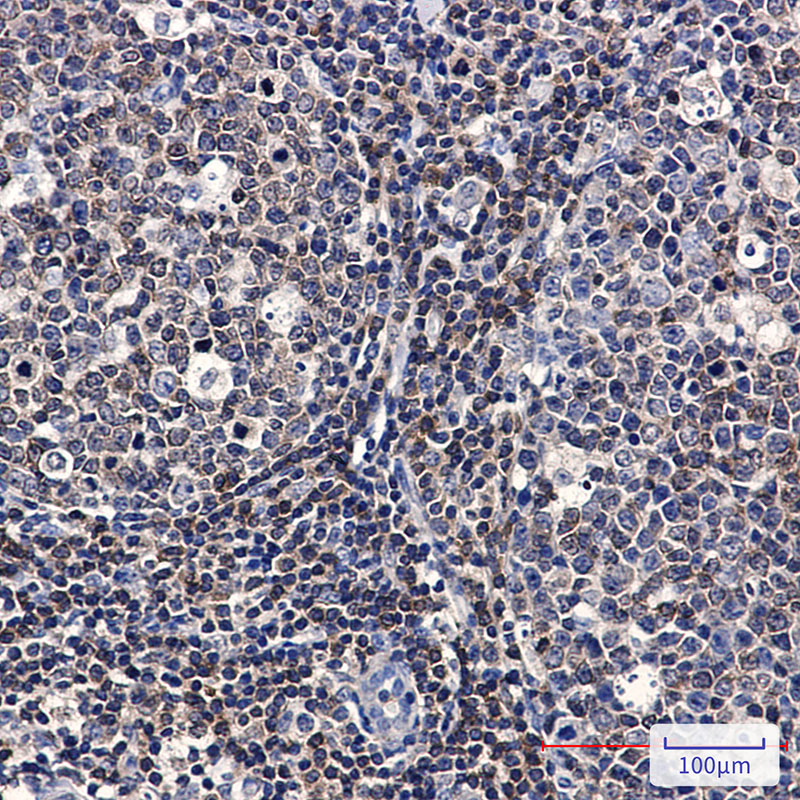 PTK2B Rabbit mAb ABZ2136