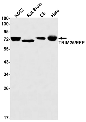 TRIM25 Rabbit mAb ABZ2137