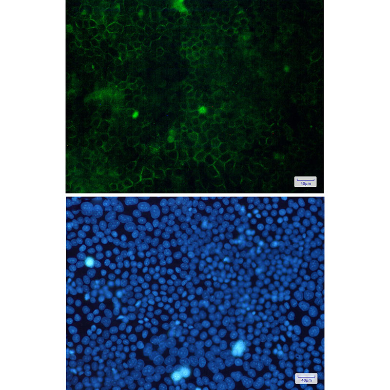 Cortactin Rabbit mAb ABZ2138