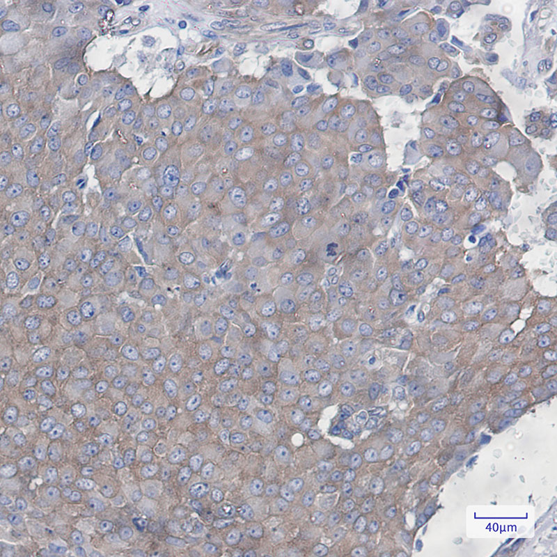 Cortactin Rabbit mAb ABZ2138
