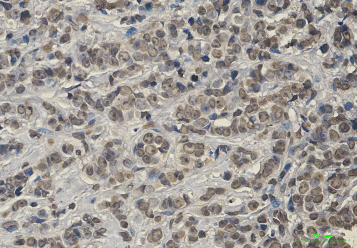 Keap1 Rabbit mAb ABZ2139