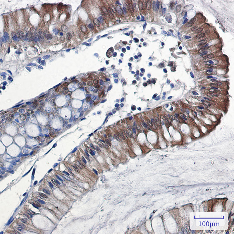 IL-18 Rabbit mAb ABZ2140