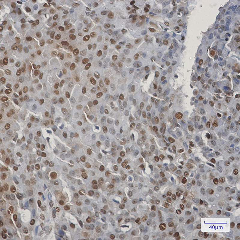 CIRBP Rabbit mAb ABZ2142
