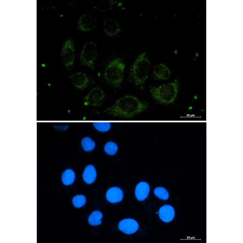Protein CASP Rabbit mAb ABZ2143
