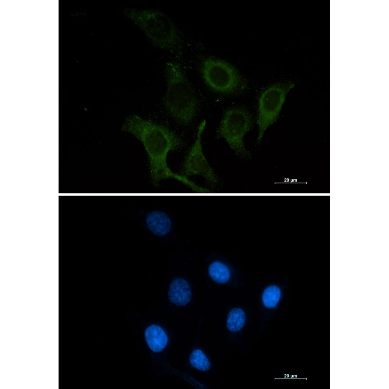 CD166 Rabbit mAb ABZ2147