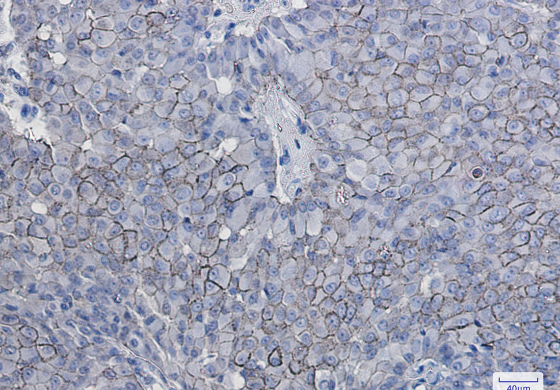 CD166 Rabbit mAb ABZ2147