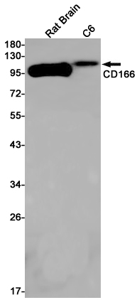 CD166 Rabbit mAb ABZ2147