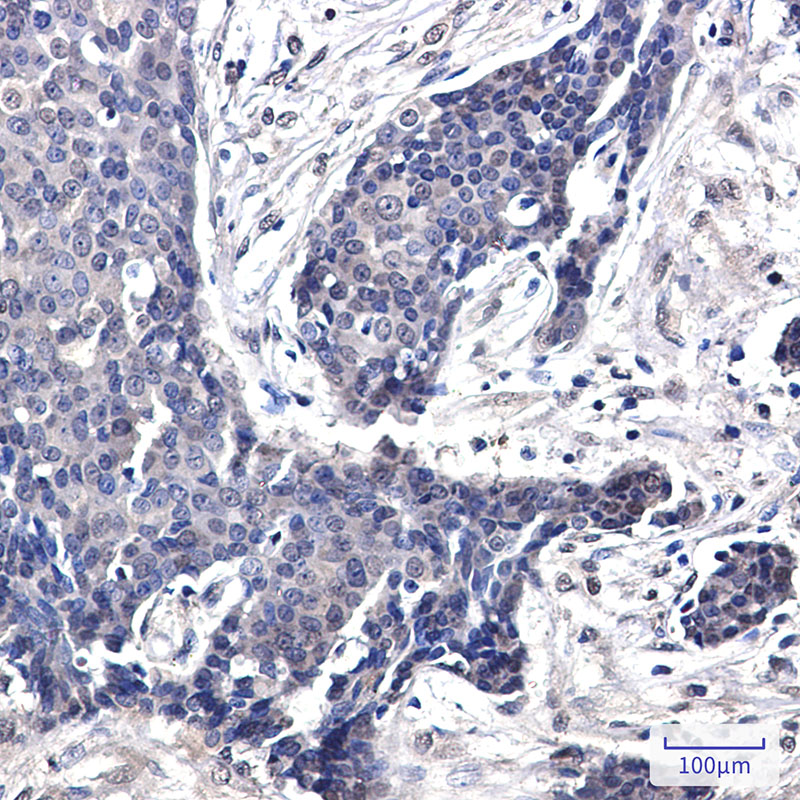 FHL1 Rabbit mAb ABZ2150