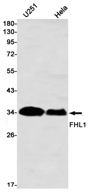 FHL1 Rabbit mAb ABZ2150