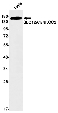 SLC12A1/NKCC2 Rabbit mAb ABZ2151
