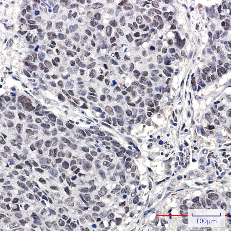 Cullin 4A/4B Rabbit mAb ABZ2152