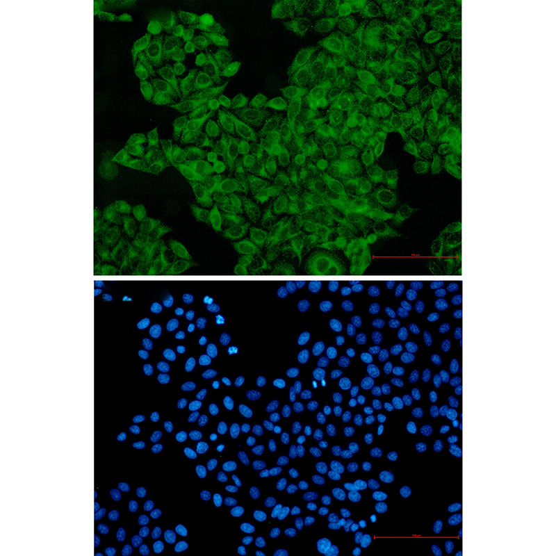 SNX1 Rabbit mAb ABZ2158