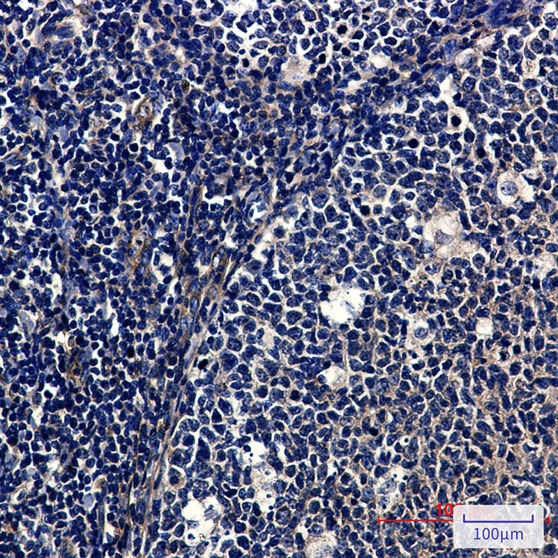 SNX1 Rabbit mAb ABZ2158