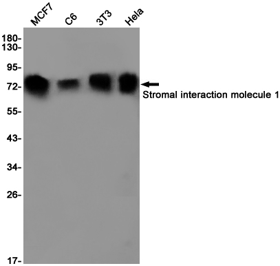 Stromal Interaction Molecule 1 Rabbit mAb ABZ2159