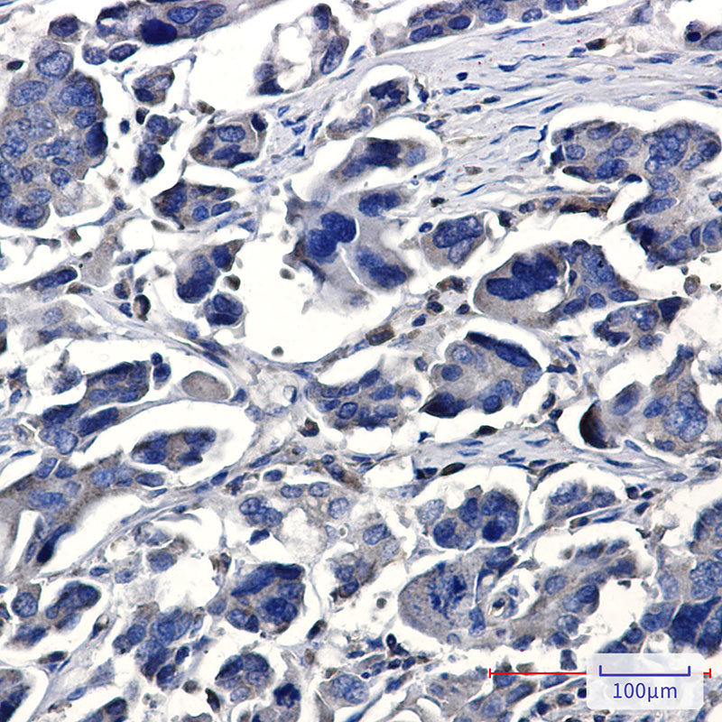 IQGAP2 Rabbit mAb ABZ2160