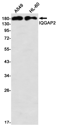 IQGAP2 Rabbit mAb ABZ2160