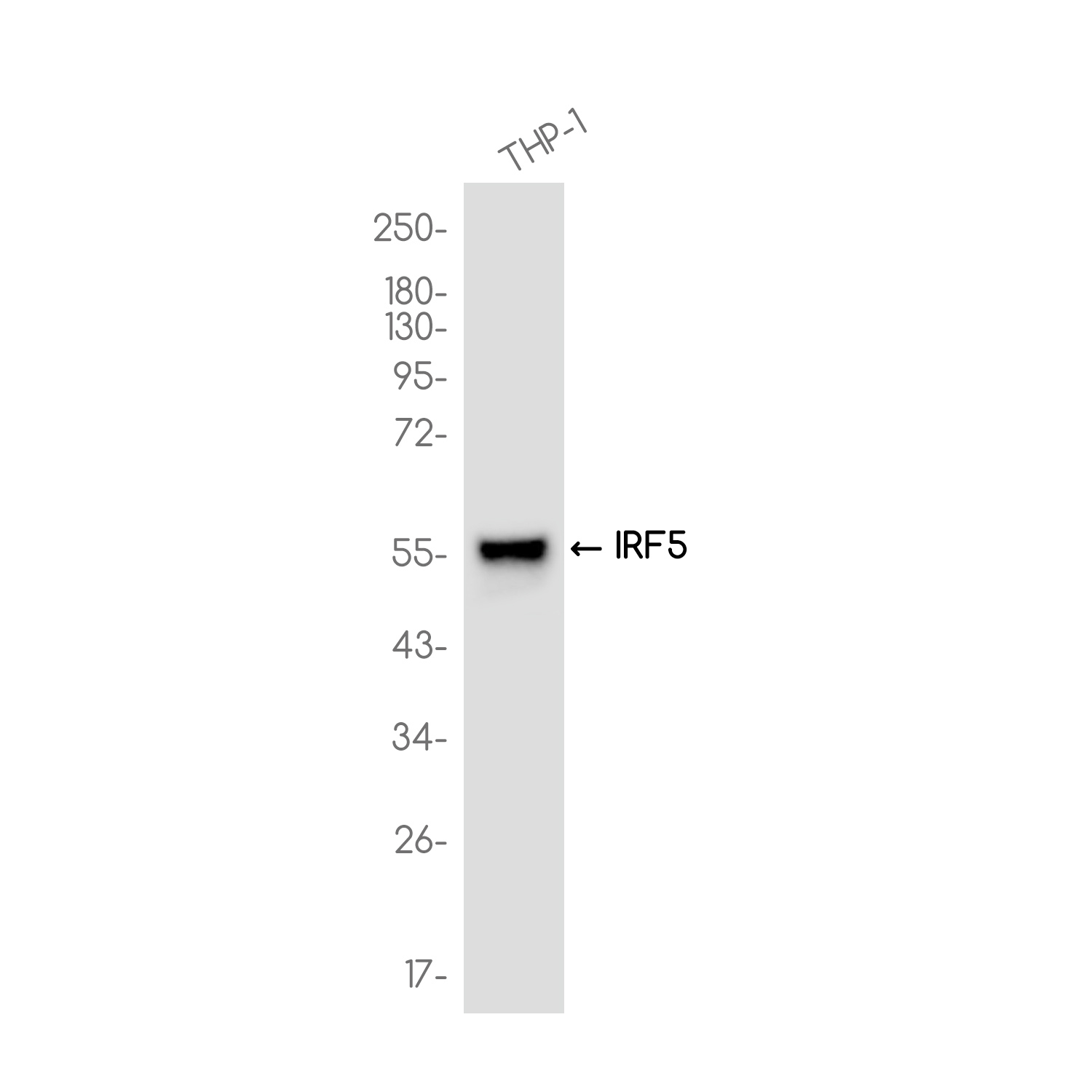 IRF5 Rabbit mAb ABZ2161