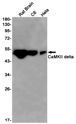 CaMKII delta Rabbit mAb ABZ2163