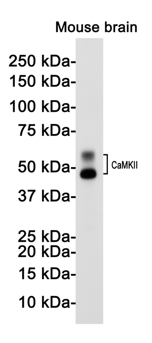 CaMKII Rabbit mAb ABZ2164