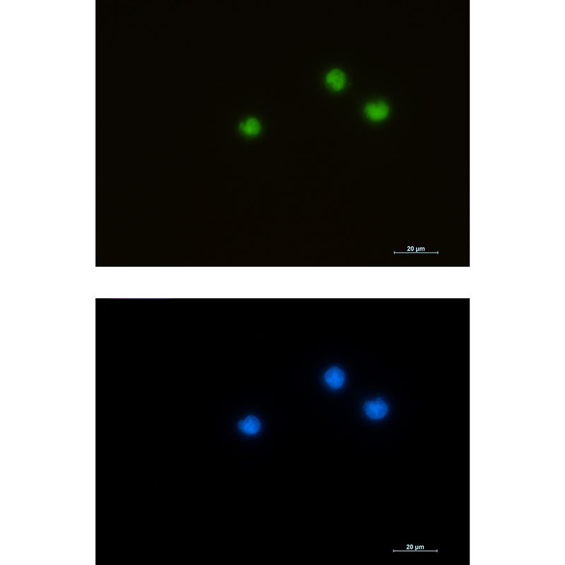 HDAC1 Rabbit mAb ABZ2165