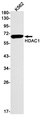 HDAC1 Rabbit mAb ABZ2165