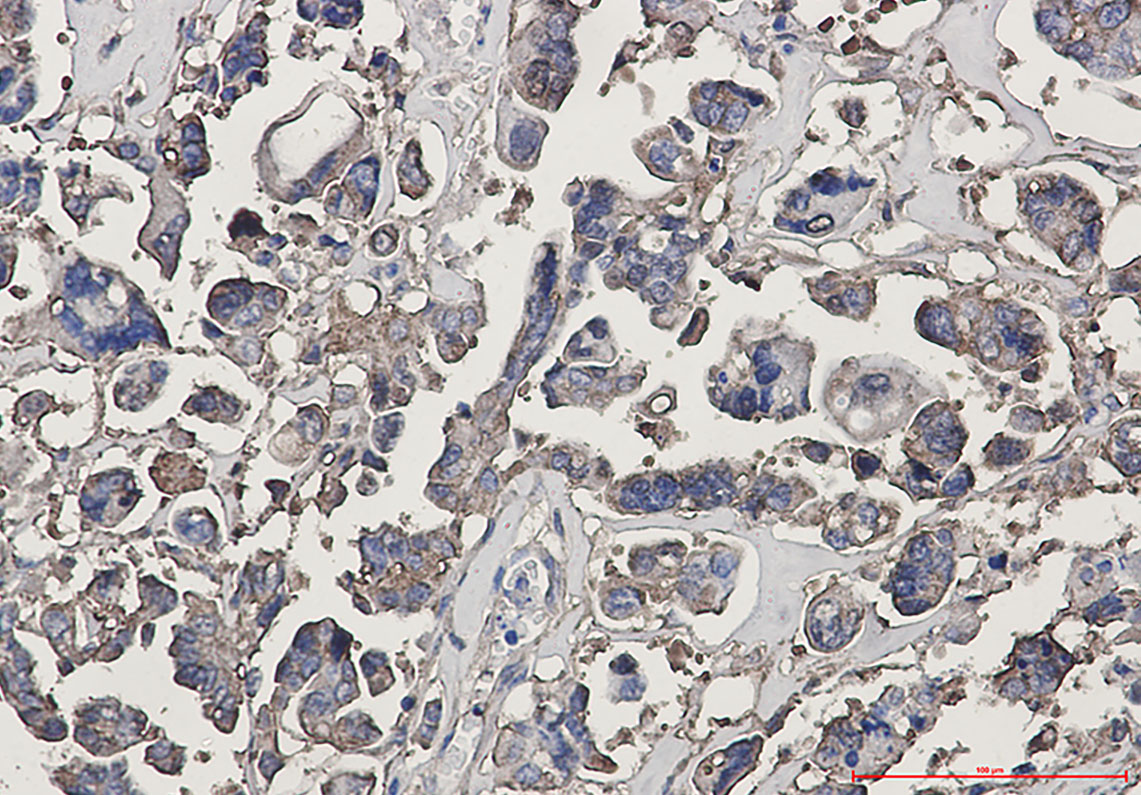 beta III Tubulin Rabbit mAb ABZ2168