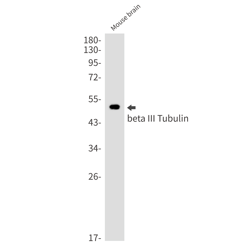 beta III Tubulin Rabbit mAb ABZ2168