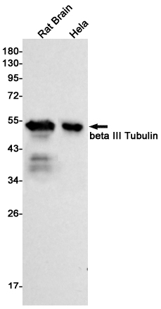 beta III Tubulin Rabbit mAb ABZ2168