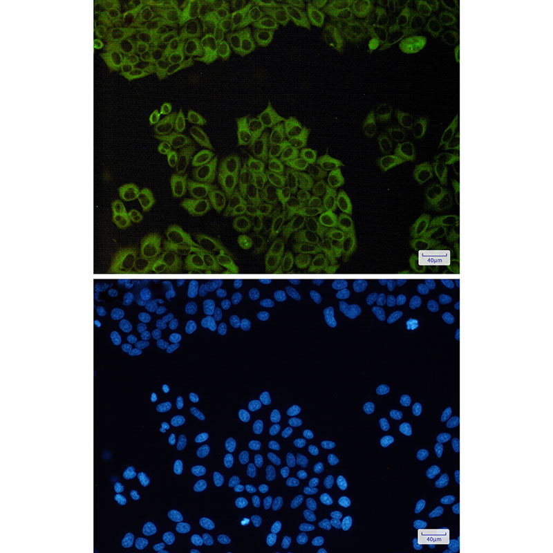 beta III Tubulin Rabbit mAb ABZ2169