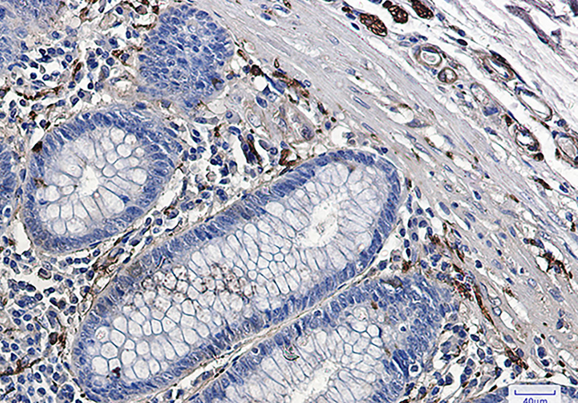 beta III Tubulin Rabbit mAb ABZ2169