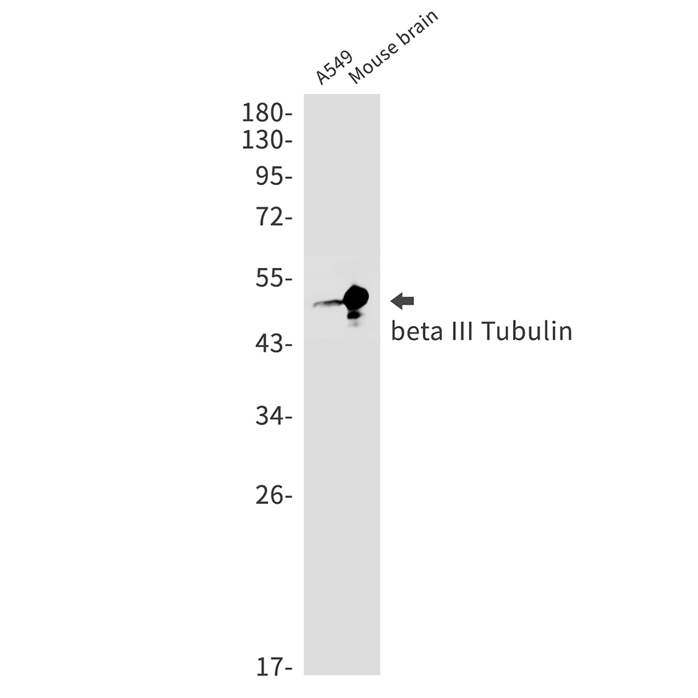 beta III Tubulin Rabbit mAb ABZ2169