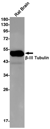 beta III Tubulin Rabbit mAb ABZ2169