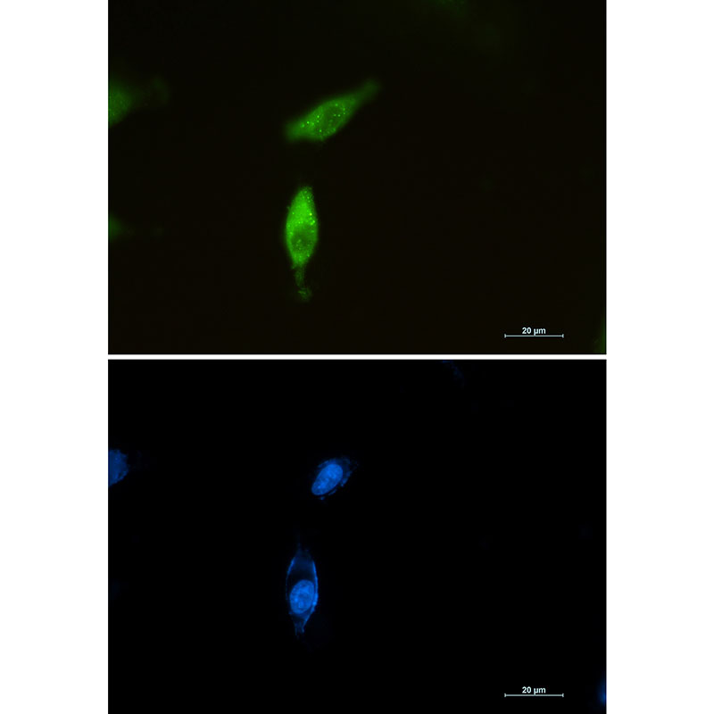SQSTM1/p62 Rabbit mAb ABZ2170