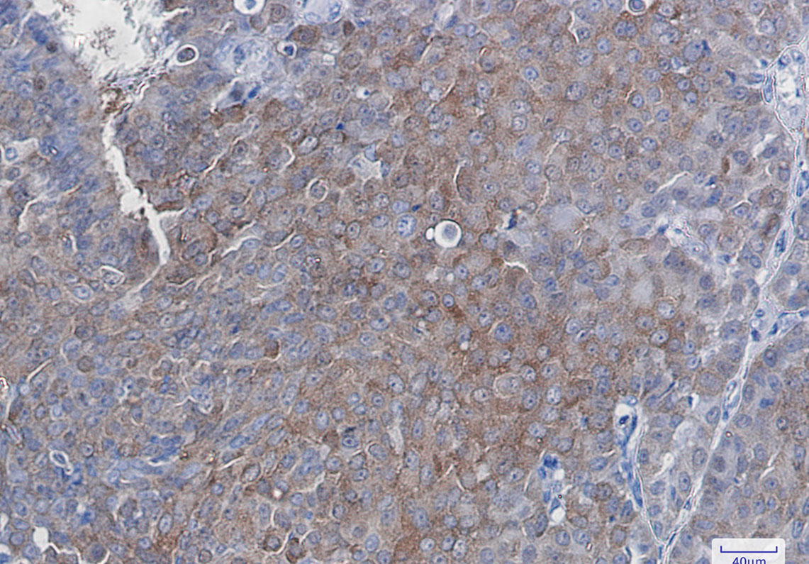 SQSTM1/p62 Rabbit mAb ABZ2170