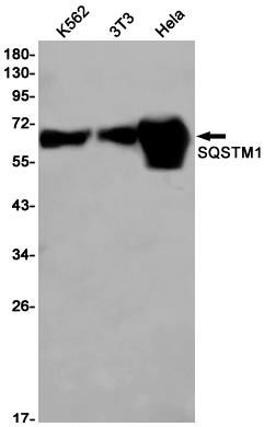 SQSTM1/p62 Rabbit mAb ABZ2170