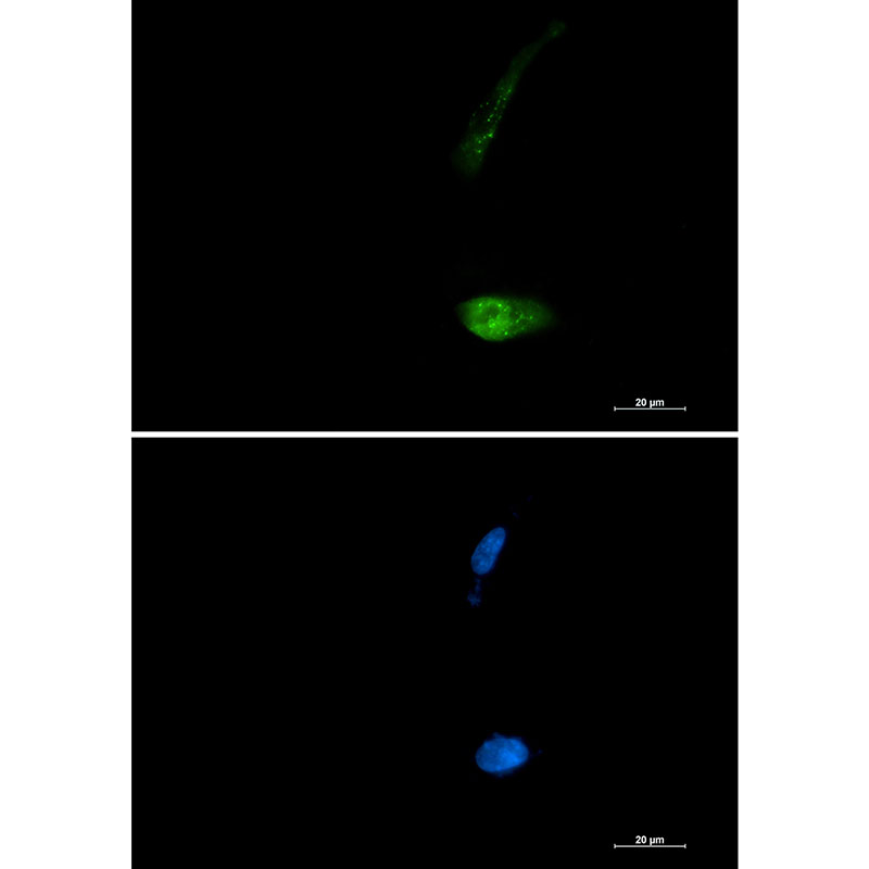 SQSTM1/p62 Rabbit mAb ABZ2171