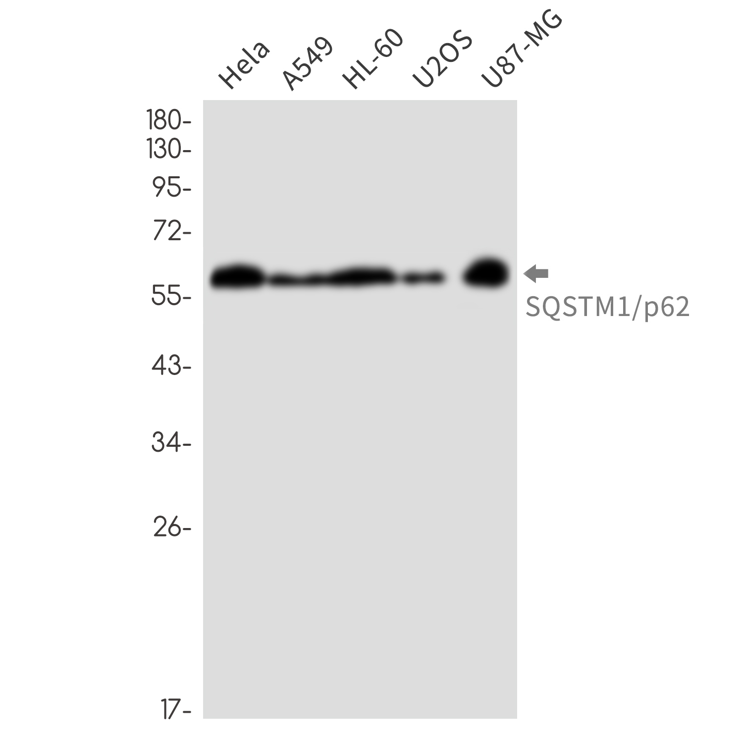 SQSTM1/p62 Rabbit mAb ABZ2171