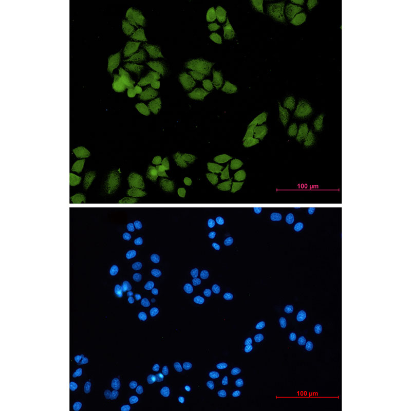 Smad4 Rabbit mAb ABZ2173